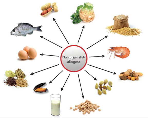 nahrungsmittel_allergene